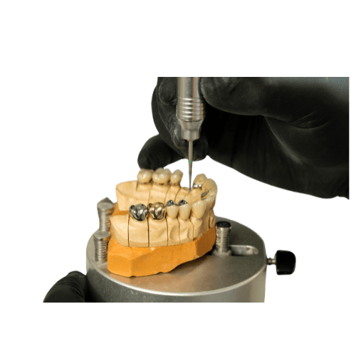 Geschiebe- und Teleskoptechnik - Professioneller Zahnersatz vom Dentallabor Muharremi in Zürich